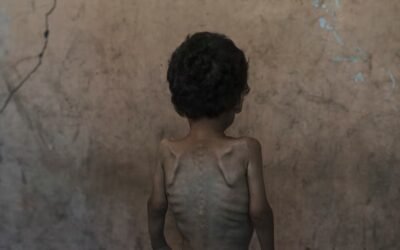 ¿Cuál es la diferencia? Genocidio en Gaza